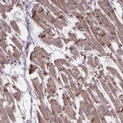 C15orf65 Antibody, Novus Biologicals:Antibodies:Primary Antibodies
